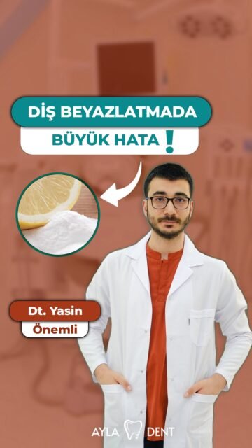 ❌ Karbonat ve limonla dişlerinizi beyazlatmaya çalışmayın!

Sosyal medyada sıkça karşılaşılan bu yöntem, dişleri beyazlatmak yerine diş minesine zarar verebilir. 🦷

🍋 Limon asidik yapısı nedeniyle diş minesinde aşınmaya yol açabilir.
🧂 Karbonat ise aşındırıcı özelliği nedeniyle yanlış veya aşırı kullanıldığında diş yüzeyine zarar verebilir.

Peki daha beyaz dişlere nasıl güvenli şekilde sahip olunur?

Diş rengindeki değişimin nedenini belirlemek ve sizin için uygun beyazlatma yöntemini seçmek için diş hekiminize danışmanız en doğru adımdır. Profesyonel diş beyazlatma yöntemleri, diş ve diş etlerinin durumu değerlendirilerek uygulanır.

⚠️ **Önemli Bilgilendirme:**
Bu içerik genel bilgilendirme amacıyla hazırlanmıştır. Kişiye özel tanı ve tedavi planlaması yalnızca muayene sonrasında, ilgili alanda yetkin diş hekimi tarafından yapılabilir.

📞 0(212) 890 11 22
🌐 www.ayladentistanbul.com
📍 Yavuz Selim Mahallesi, Birlik Caddesi, No:89 Bağcılar, İstanbul

#dişbeyazlatma #dişhekimi #dişsağlığı #bağcılar #istanbuldişkliniği