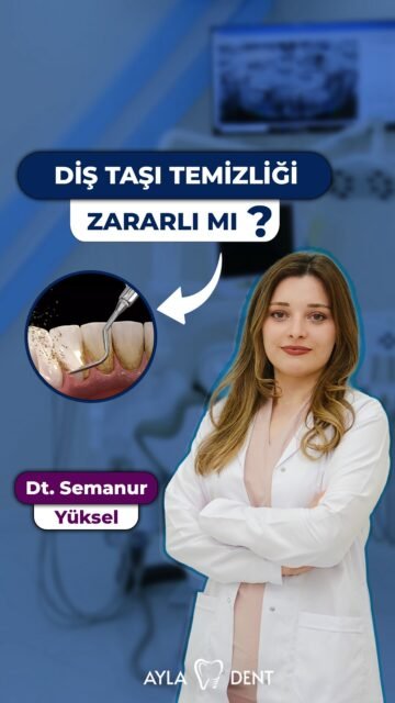 Diş taşı temizliği yaptırmak gerçekten dişlere zarar verebilir mi? 🦷

Bu konuda yıllardır doğru bilinen yanlışlar var. Peki hangisi doğru?

Cevabı videoda. 👇

⚠️ *Önemli Bilgilendirme:*
Bu içerik genel bilgilendirme amacıyla hazırlanmıştır. Kişiye özel tanı ve tedavi planlaması yalnızca muayene sonrasında, ilgili alanda yetkin diş hekimi tarafından yapılabilir.

📞 0(212) 890 11 22
🌐 www.ayladentistanbul.com
📍 Yavuz Selim Mahallesi, Birlik Caddesi, No:89 Bağcılar, İstanbul

#diştaşı #diştaşıtemizliği #dişsağlığı #dişhekimi #ağızsağlığı